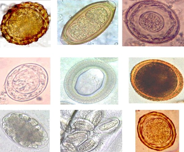 helminths parasitic metazoans and prevention essay helminths parasitic metazoans and prevention essay