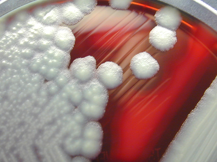 Bacillus cereus Wiki Everipedia