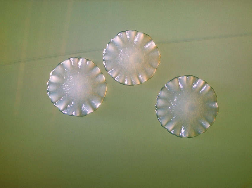 Actinomyces neuii Wiki Everipedia