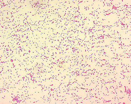 Brucellosis | Wiki | Everipedia